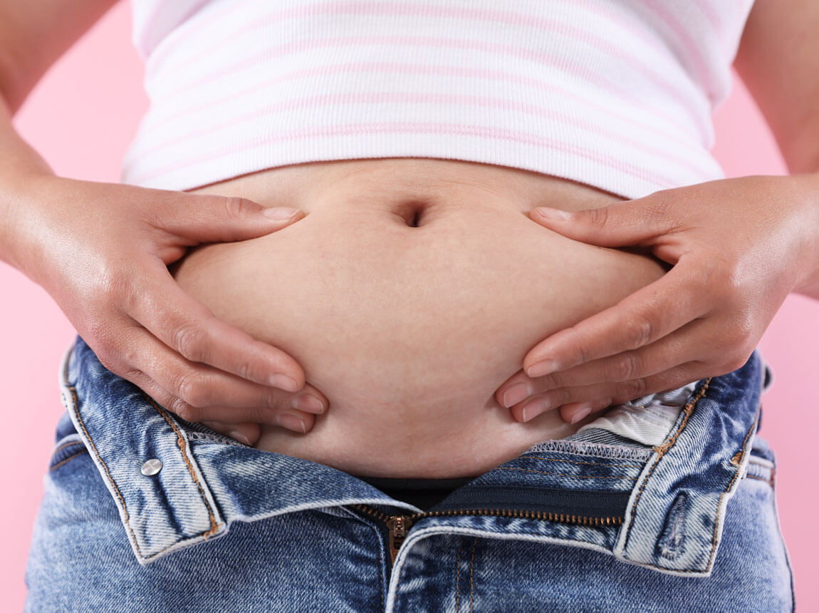 nadváha v oblasti brucha