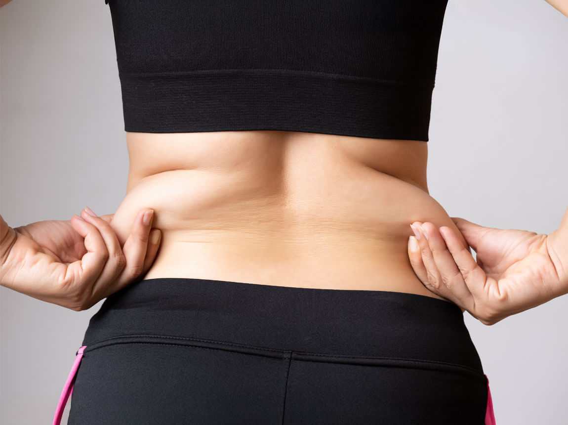 žena - problémy s chudnutím - boky