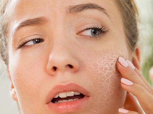 Ako sa starať o suchú pokožku? Vitamíny a doplnky pre suchú pokožku
