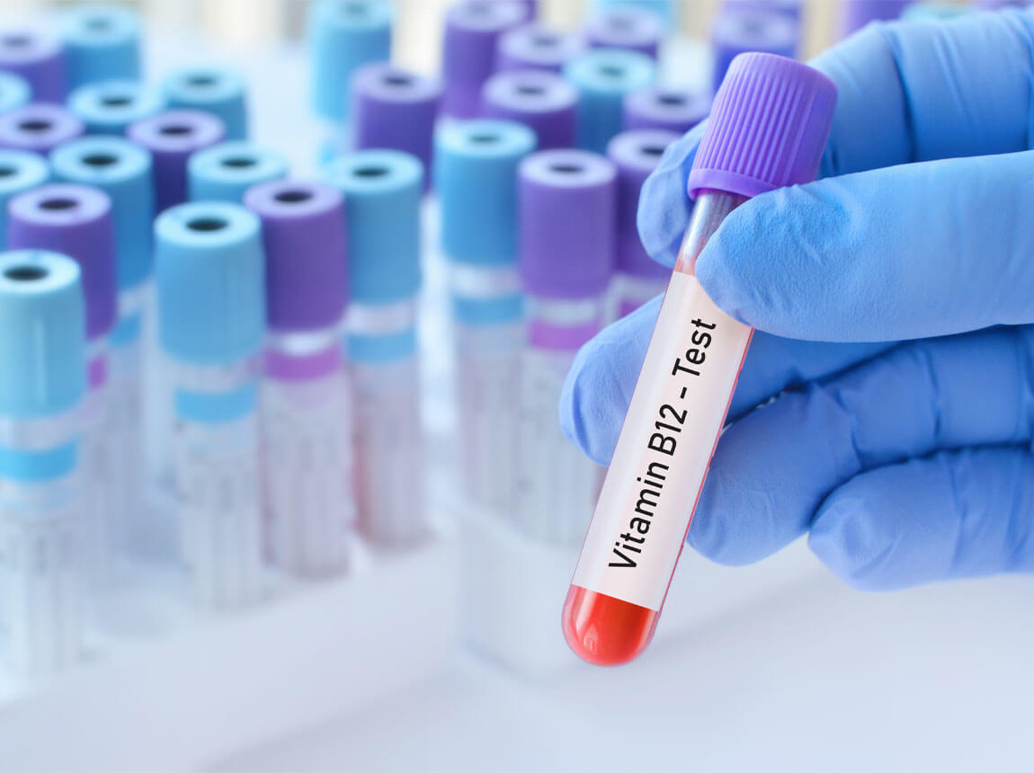 Vitamín B12